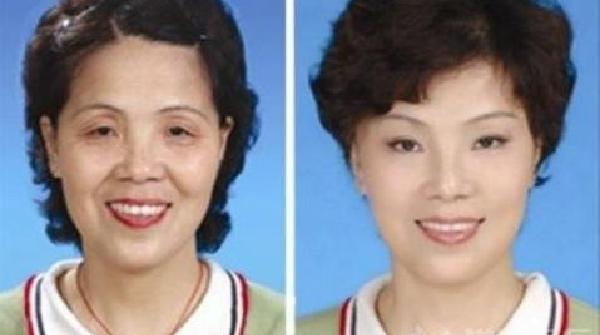 从图中我们可以看到整容的蔷薇大年夜妈眼睛变大年夜了,且皱纹也不见